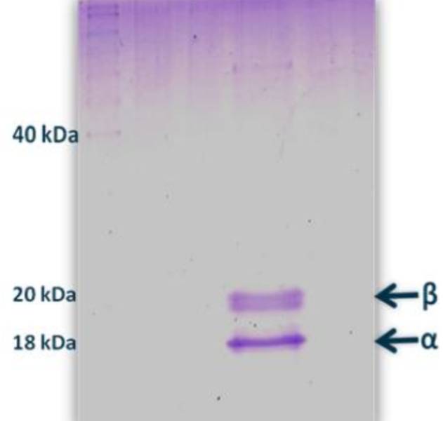 Biomarkers